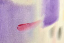 Cellular Reaction Image 11